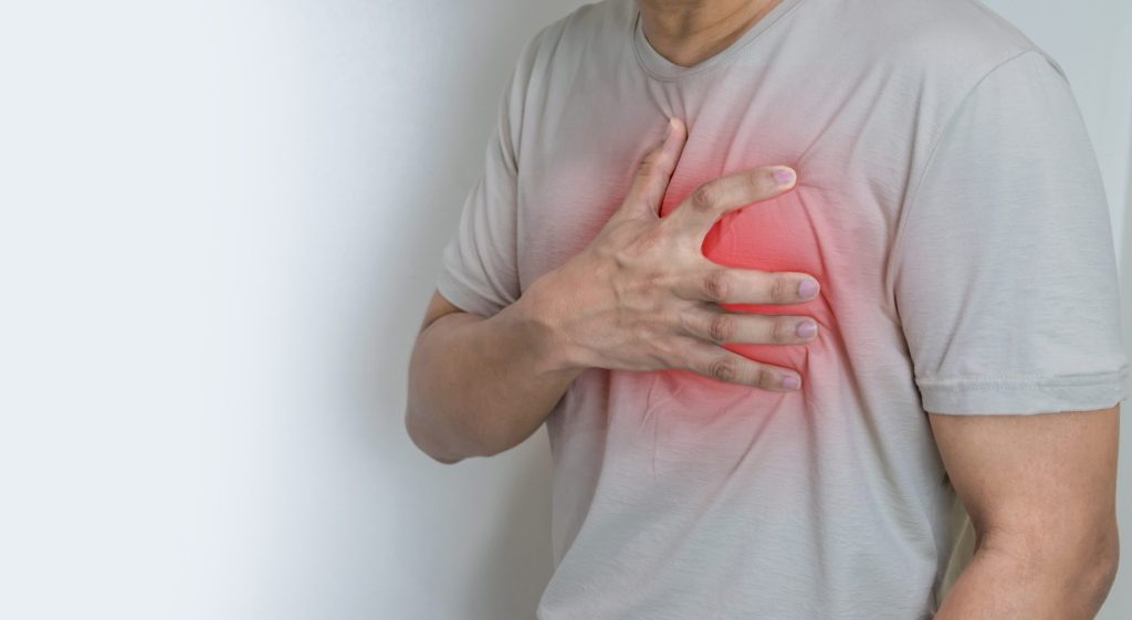 Infarto